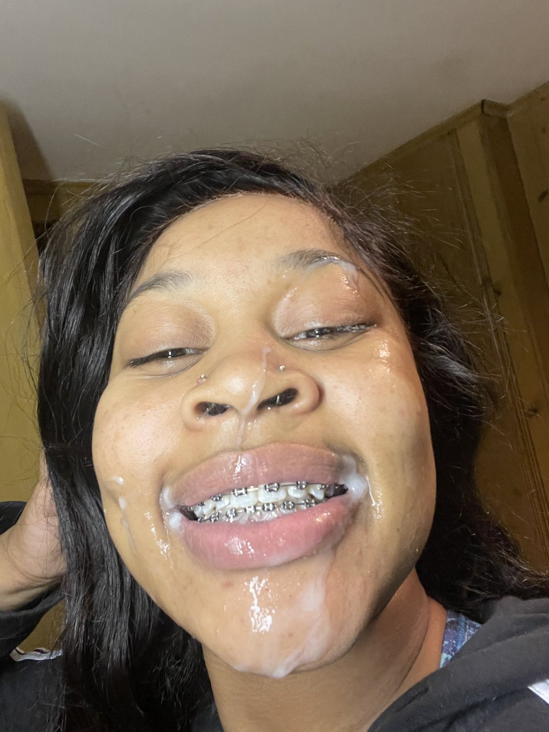 Brace face NuttyNyellie #FUCqFbde